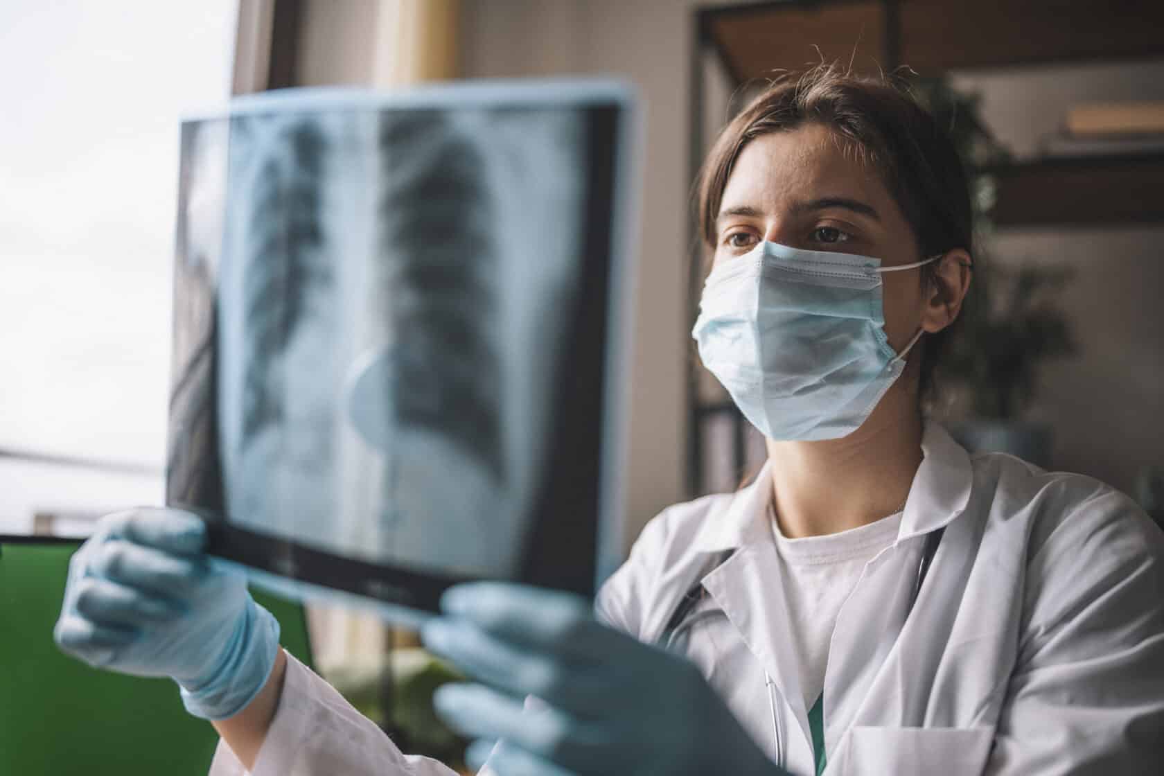 Ärztin analysiert Röntgenaufnahme einer Lunge
